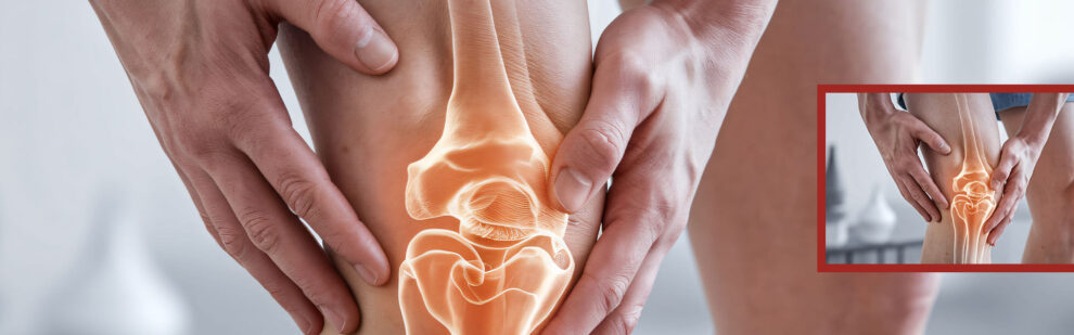 Hände halten ein Knie, das mit einer halbtransparenten Darstellung eines künstlichen Kniegelenks überlagert ist.