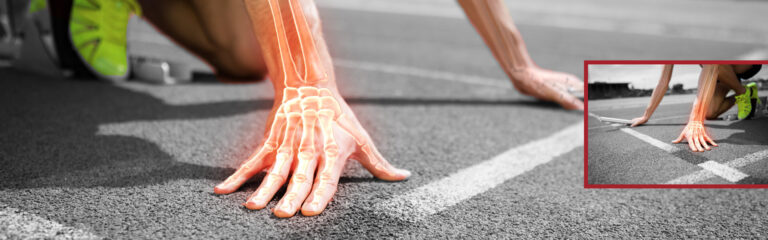 Nahaufnahme einer Hand mit eingeblendeter Knochenstruktur auf Asphalt mit weißen Markierungen, daneben eine kleinere Ansicht der gesamten Startposition eines Läufers.
